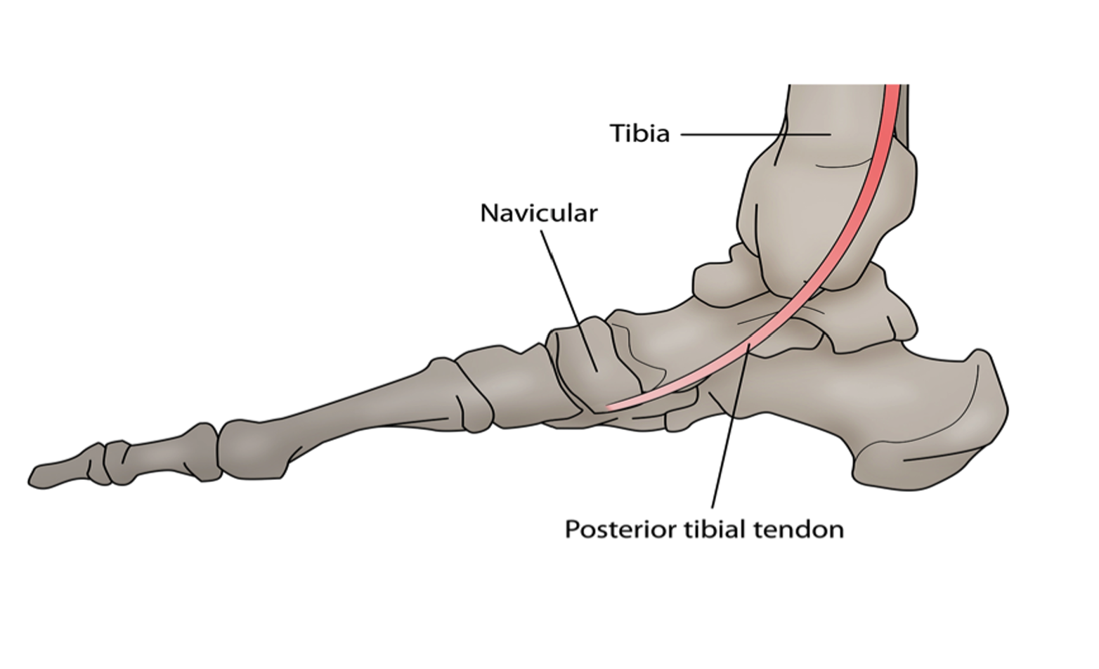 posterior tibial tendon diagram.