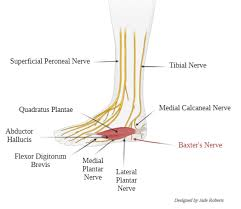 diagram of baxter's nerve entrapment doc