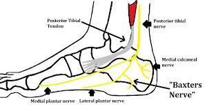 diagram of a foot with baxters nerve entrapment
