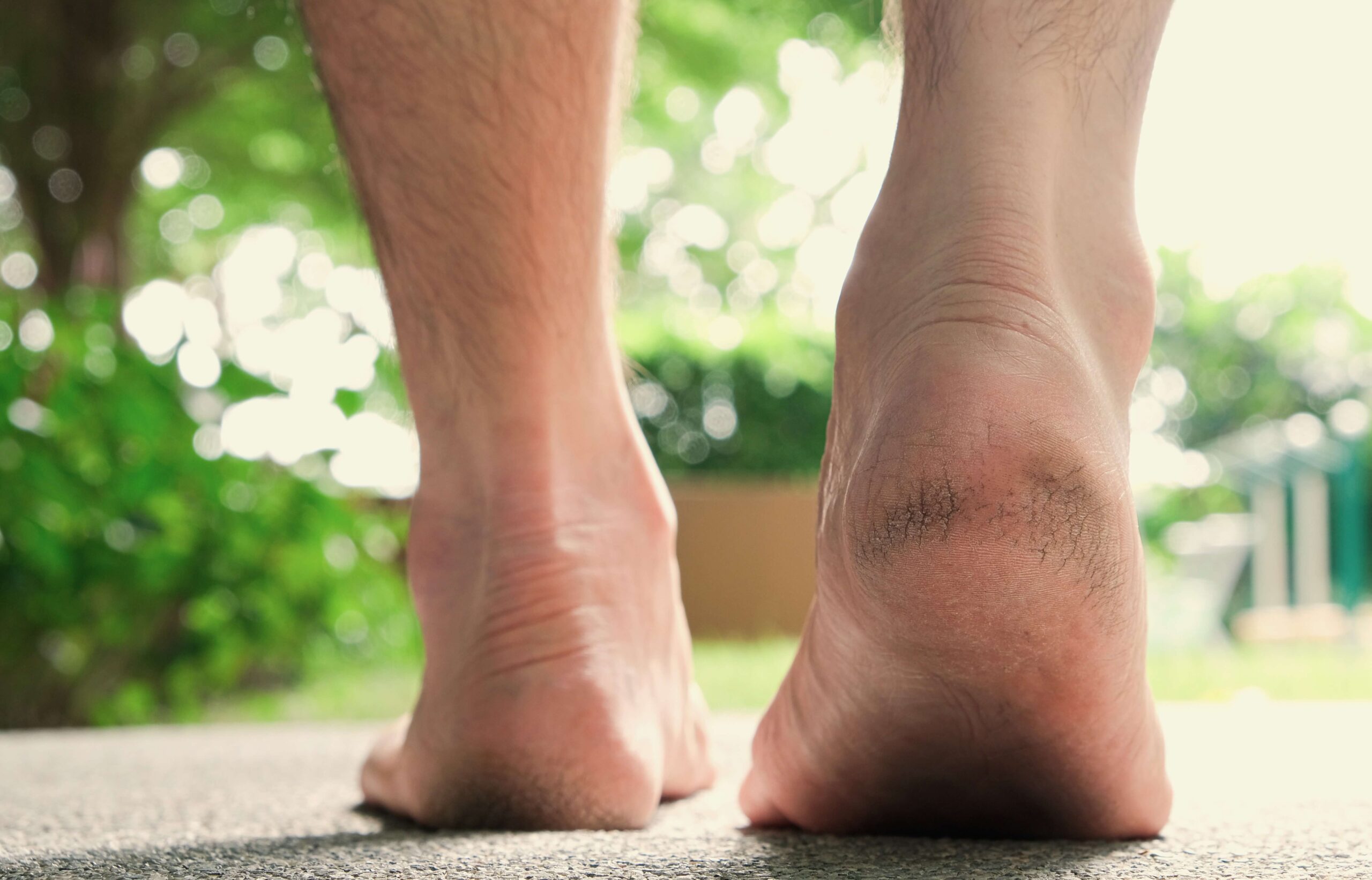 Heel Pad for Heel Pain Heel Socks Anti Crack Silicon Gel Heel And Foot  Protector Moisturizing